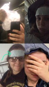 Images of Natalie with cold compresses, covering her eyes and in a dark room with her hood up while experiencing migraine attacks.