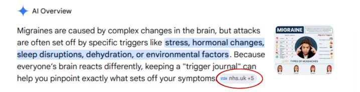 An example of an AI summary of migraine